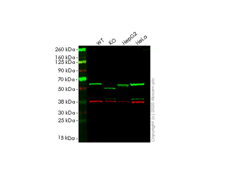 Western blot - Anti-SQSTM1 / p62 antibody [EPR18351] - Autophagosome Marker (AB207305)