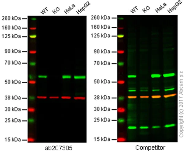 Western blot - Anti-SQSTM1 / p62 antibody [EPR18351] - Autophagosome Marker (AB207305)