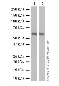 Western blot - Anti-SQSTM1 / p62 antibody [EPR18351] - Autophagosome Marker (AB207305)