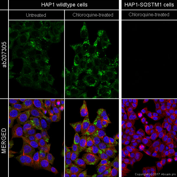 Immunocytochemistry/ Immunofluorescence - Anti-SQSTM1 / p62 antibody [EPR18351] - BSA and Azide free (ab227992), expandable thumbnail