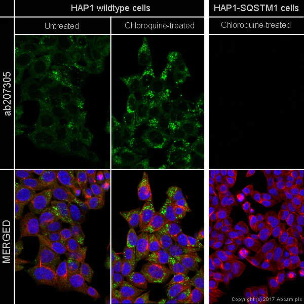 Immunocytochemistry/ Immunofluorescence - Anti-SQSTM1 / p62 antibody [EPR18351] - BSA and Azide free (AB227992)