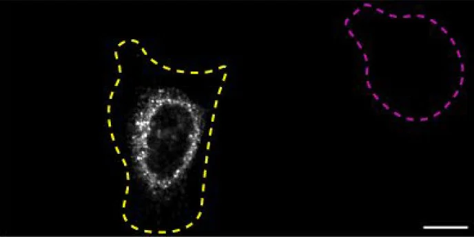Immunocytochemistry/ Immunofluorescence - Anti-SQSTM1 / p62 antibody [EPR18351] - BSA and Azide free (AB227992)