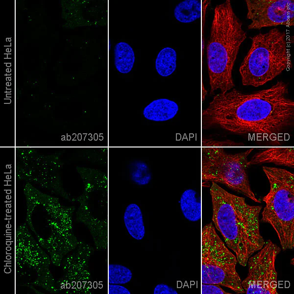 Immunocytochemistry/ Immunofluorescence - Anti-SQSTM1 / p62 antibody [EPR18351] - BSA and Azide free (AB227992)
