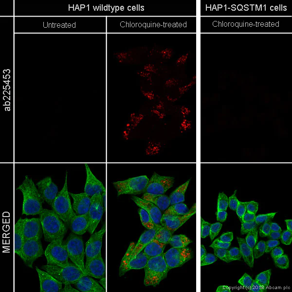 Immunocytochemistry/ Immunofluorescence - Anti-SQSTM1 / p62 antibody [EPR18351] - BSA and Azide free (AB227992)