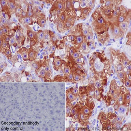 Immunohistochemistry (Formalin/PFA-fixed paraffin-embedded sections) - Anti-SQSTM1 / p62 antibody [EPR18351] - BSA and Azide free (AB227992)