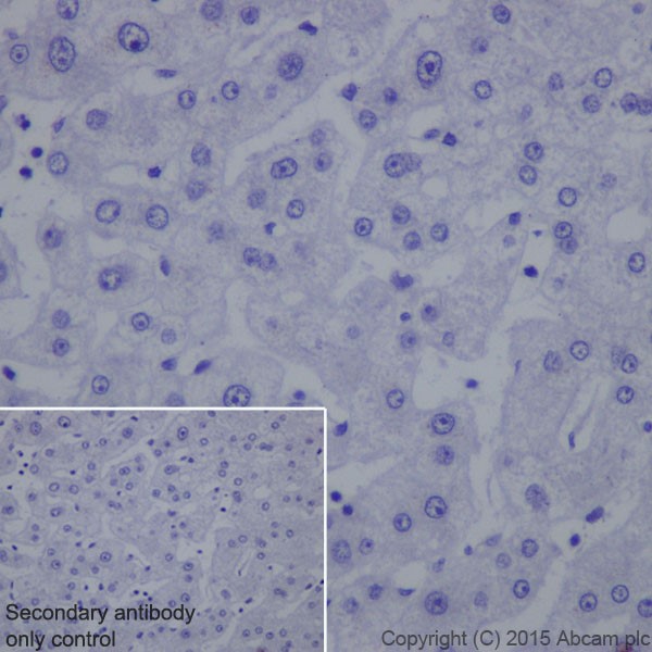 Immunohistochemistry (Formalin/PFA-fixed paraffin-embedded sections) - Anti-SQSTM1 / p62 antibody [EPR18351] - BSA and Azide free (ab227992), expandable thumbnail