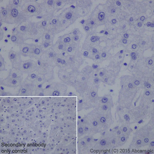 Immunohistochemistry (Formalin/PFA-fixed paraffin-embedded sections) - Anti-SQSTM1 / p62 antibody [EPR18351] - BSA and Azide free (AB227992)