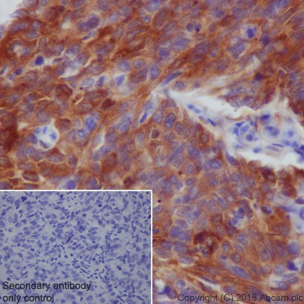 Immunohistochemistry (Formalin/PFA-fixed paraffin-embedded sections) - Anti-SQSTM1 / p62 antibody [EPR18351] - BSA and Azide free (AB227992)