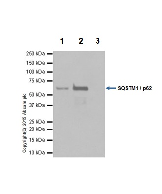 Immunoprecipitation - Anti-SQSTM1 / p62 antibody [EPR18351] - BSA and Azide free (AB227992), expandable thumbnail