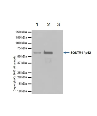 Immunoprecipitation - Anti-SQSTM1 / p62 antibody [EPR18351] - BSA and Azide free (AB227992)