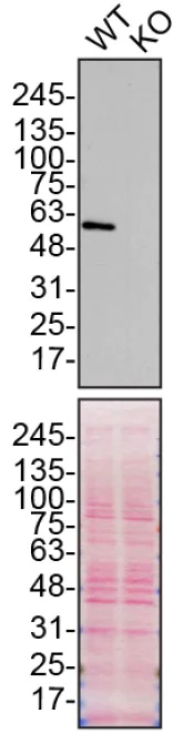Western blot - Anti-SQSTM1 / p62 antibody [EPR18351] - BSA and Azide free (AB227992)