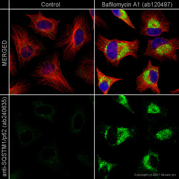 Immunocytochemistry/ Immunofluorescence - Anti-SQSTM1 / p62 antibody [EPR23101-103] - Autophagosome Marker (AB240635)