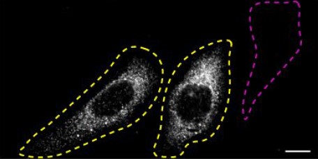 Immunocytochemistry/ Immunofluorescence - Anti-SQSTM1 / p62 antibody [EPR23101-103] (ab240635), expandable thumbnail