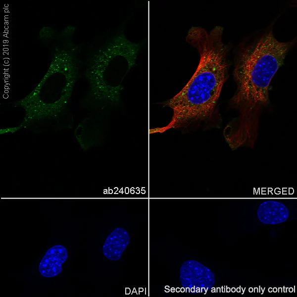 Immunocytochemistry/ Immunofluorescence - Anti-SQSTM1 / p62 antibody [EPR23101-103] - Autophagosome Marker (AB240635)