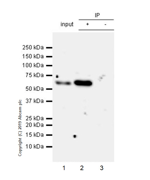 Immunoprecipitation - Anti-SQSTM1 / p62 antibody [EPR23101-103] - Autophagosome Marker (AB240635), expandable thumbnail