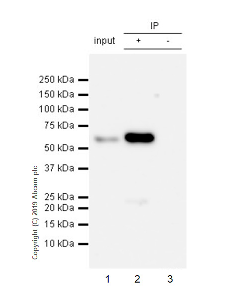 Immunoprecipitation - Anti-SQSTM1 / p62 antibody [EPR23101-103] - Autophagosome Marker (ab240635), expandable thumbnail