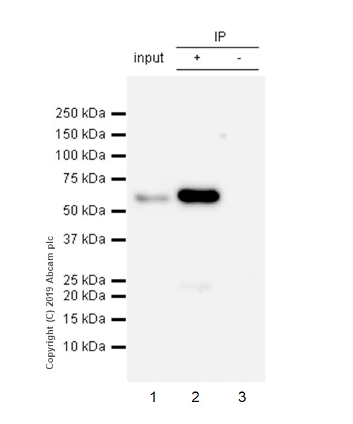 Immunoprecipitation - Anti-SQSTM1 / p62 antibody [EPR23101-103] - Autophagosome Marker (AB240635)