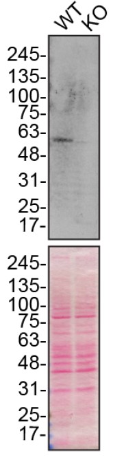 Western blot - Anti-SQSTM1 / p62 antibody [EPR23101-103] - Autophagosome Marker (AB240635), expandable thumbnail