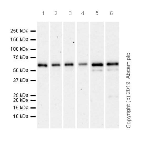 Western blot - Anti-SQSTM1 / p62 antibody [EPR23101-103] - Autophagosome Marker (ab240635), expandable thumbnail