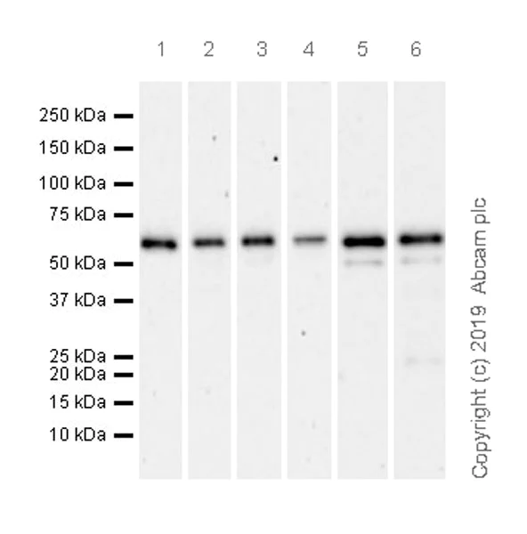 Western blot - Anti-SQSTM1 / p62 antibody [EPR23101-103] - Autophagosome Marker (AB240635)