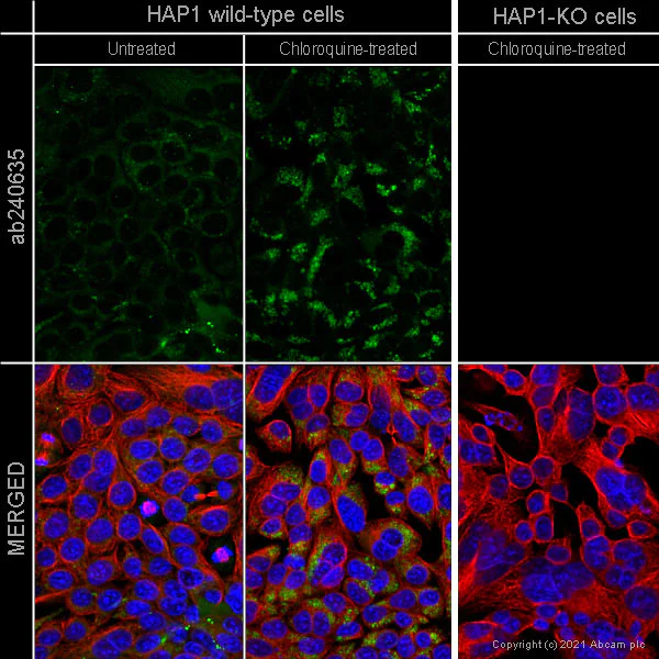 Immunocytochemistry - Anti-SQSTM1 / p62 antibody [EPR23101-103] - BSA and Azide free (AB269458)