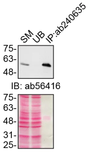 Immunoprecipitation - Anti-SQSTM1 / p62 antibody [EPR23101-103] - BSA and Azide free (AB269458)