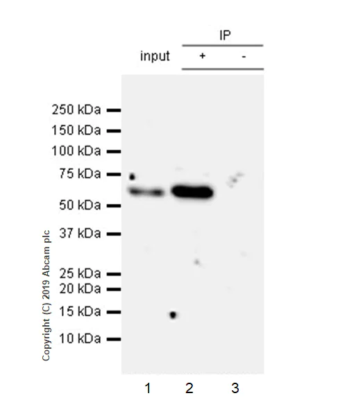 Immunoprecipitation - Anti-SQSTM1 / p62 antibody [EPR23101-103] - BSA and Azide free (AB269458)