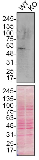 Western blot - Anti-SQSTM1 / p62 antibody [EPR23101-103] - BSA and Azide free (AB269458)