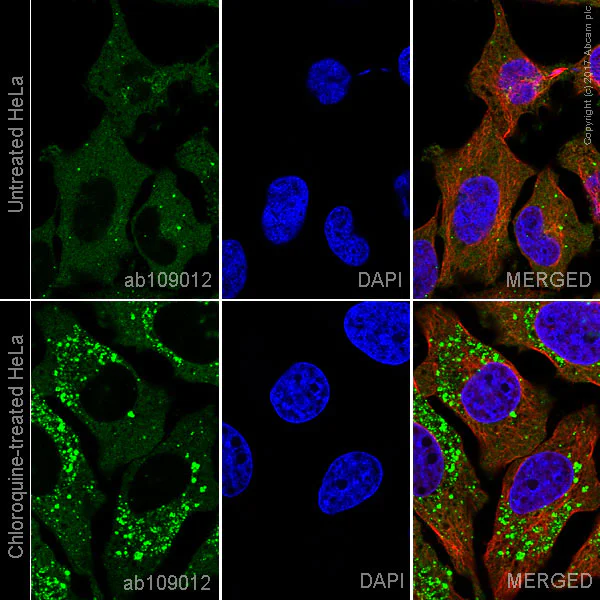 Immunocytochemistry/ Immunofluorescence - Anti-SQSTM1 / p62 antibody [EPR4844] - Autophagosome Marker (AB109012)