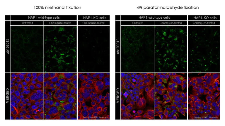 Immunocytochemistry/ Immunofluorescence - Anti-SQSTM1 / p62 antibody [EPR4844] - Autophagosome Marker (AB109012)