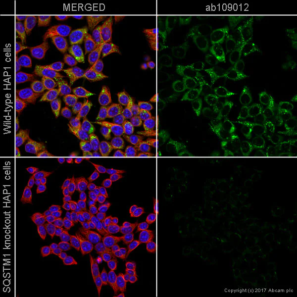 Immunocytochemistry/ Immunofluorescence - Anti-SQSTM1 / p62 antibody [EPR4844] - Autophagosome Marker (AB109012)
