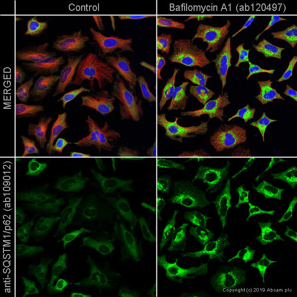 Immunocytochemistry/ Immunofluorescence - Anti-SQSTM1 / p62 antibody [EPR4844] - Autophagosome Marker (AB109012)