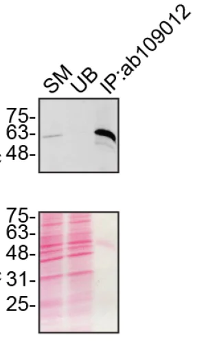 Immunoprecipitation - Anti-SQSTM1 / p62 antibody [EPR4844] - Autophagosome Marker (AB109012)