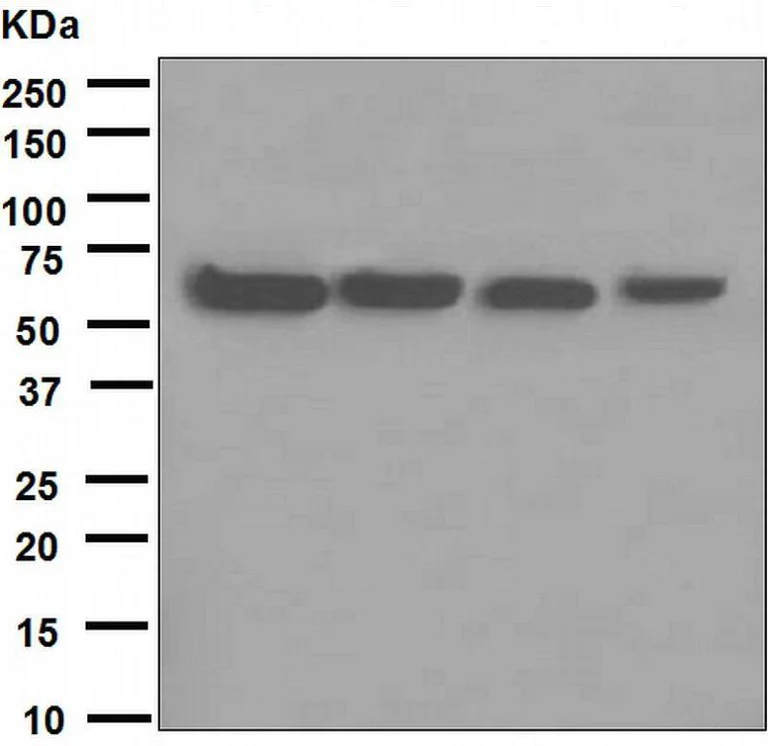 Western blot - Anti-SQSTM1 / p62 antibody [EPR4844] - Autophagosome Marker (AB109012)