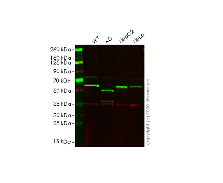 Western blot - Anti-SQSTM1 / p62 antibody [EPR4844] - Autophagosome Marker (AB109012)