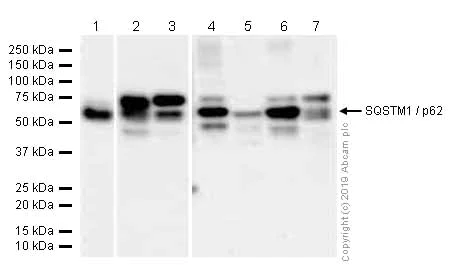 Western blot - Anti-SQSTM1 / p62 antibody [EPR4844] - Autophagosome Marker (AB109012)