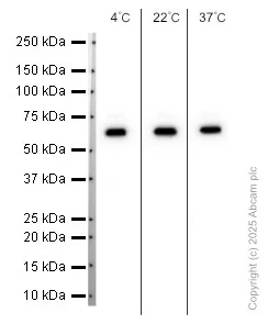Western blot - Anti-SQSTM1 / p62 antibody [EPR4844] - Autophagosome Marker (AB109012)