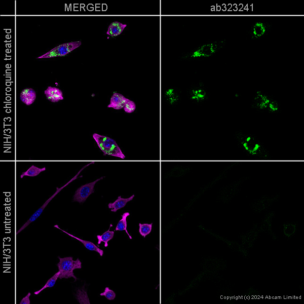 Immunocytochemistry/ Immunofluorescence - Anti-SQSTM1 / p62 antibody [EPR4844] - Autophagosome Marker – Goat IgG (Chimeric) (AB323241), expandable thumbnail