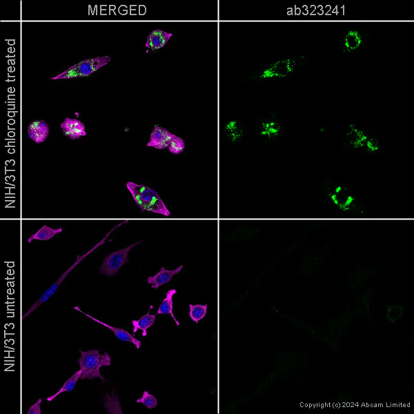 Immunocytochemistry/ Immunofluorescence - Anti-SQSTM1 / p62 antibody [EPR4844] - Autophagosome Marker – Goat IgG (Chimeric) (AB323241)