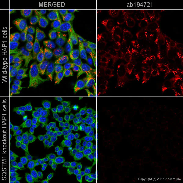 Immunocytochemistry/ Immunofluorescence - Anti-SQSTM1 / p62 antibody [EPR4844] - BSA and Azide free (AB219581)