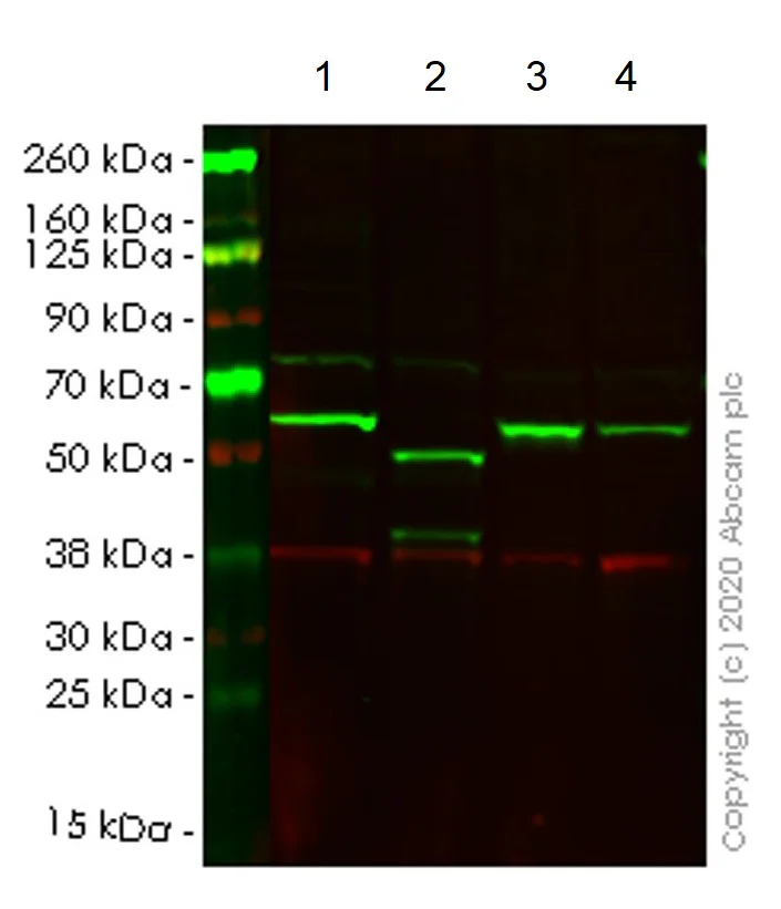 Western blot - Anti-SQSTM1 / p62 antibody [EPR4844] - BSA and Azide free (AB219581)