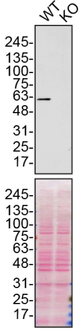 Western blot - Anti-SQSTM1 / p62 antibody [EPR4844] - BSA and Azide free (AB219581)