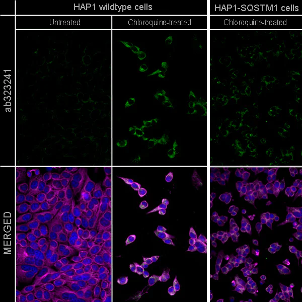 Immunocytochemistry/ Immunofluorescence - Anti-SQSTM1 / p62 antibody [EPR4844] - Goat IgG (Chimeric) – BSA and Azide Free (AB323250)