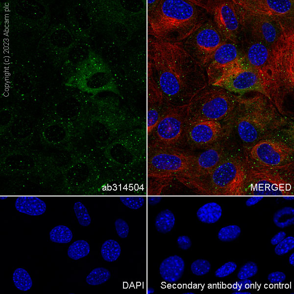 Immunocytochemistry/ Immunofluorescence - Anti-SQSTM1 / p62 antibody [RM1079] (ab314504), expandable thumbnail