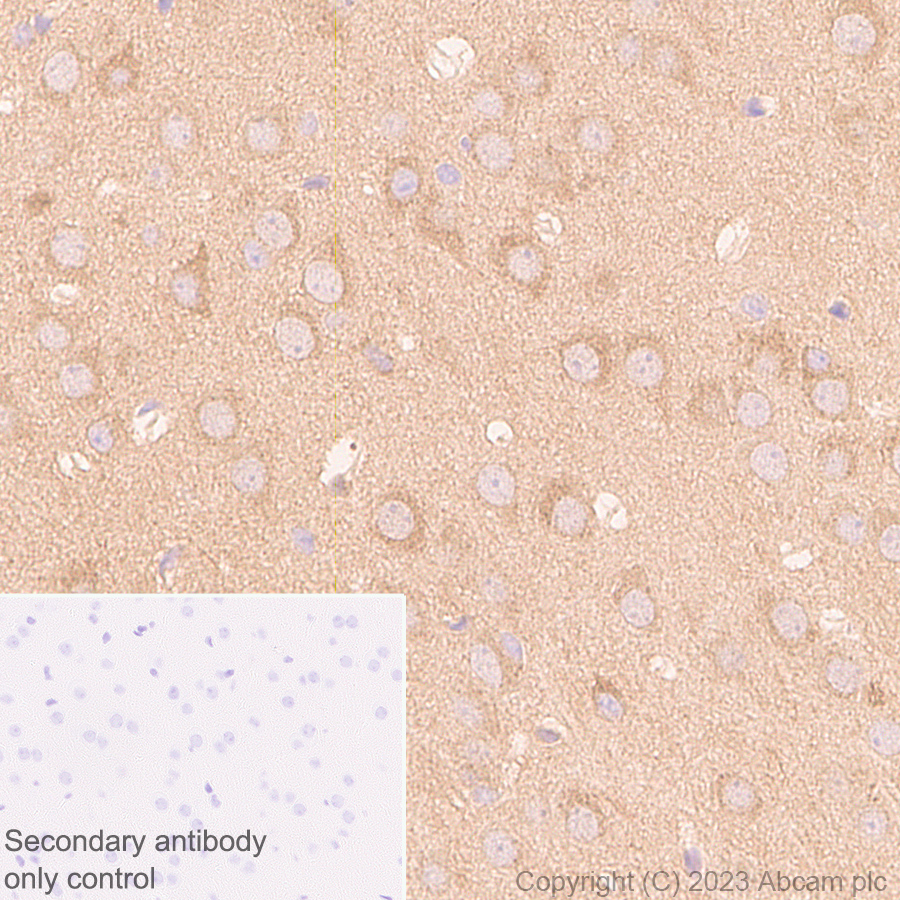 Immunohistochemistry (Formalin/PFA-fixed paraffin-embedded sections) - Anti-SQSTM1 / p62 antibody [RM1079] (ab314504), expandable thumbnail