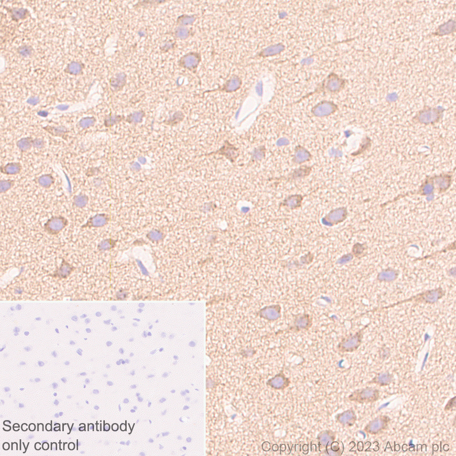 Immunohistochemistry (Formalin/PFA-fixed paraffin-embedded sections) - Anti-SQSTM1 / p62 antibody [RM1079] (ab314504), expandable thumbnail