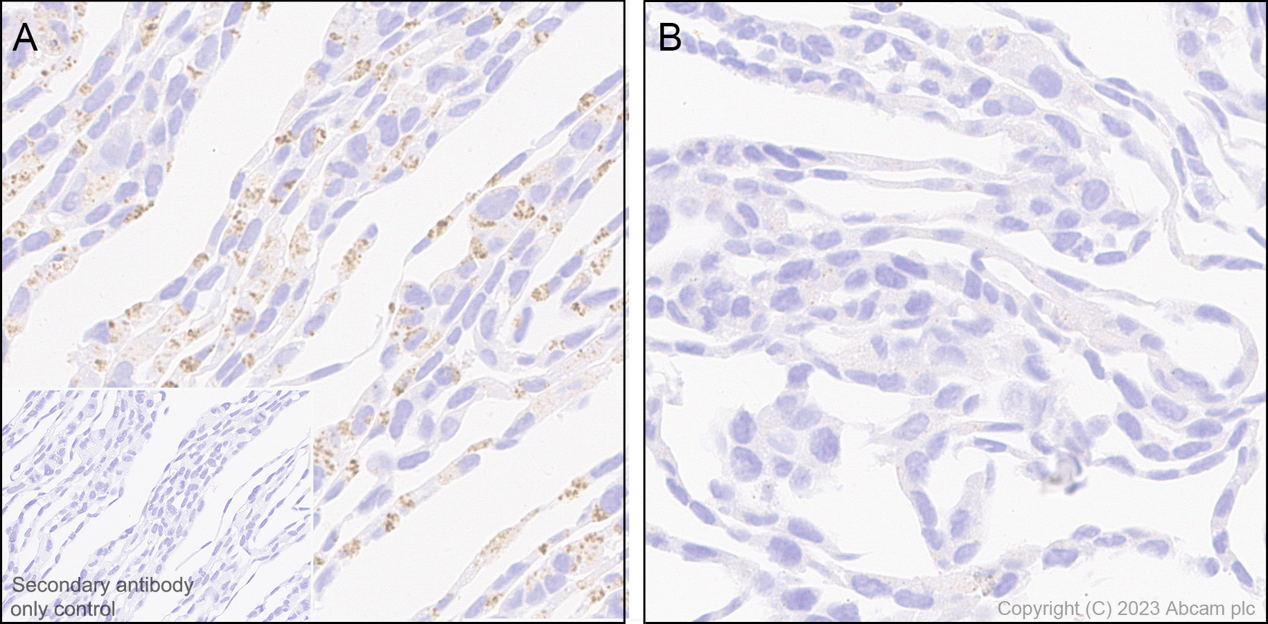 Immunohistochemistry (Formalin/PFA-fixed paraffin-embedded sections) - Anti-SQSTM1 / p62 antibody [RM1079] (AB314504), expandable thumbnail