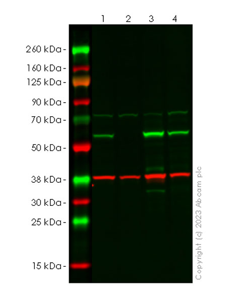 Western blot - Anti-SQSTM1 / p62 antibody [RM1079] (AB314504), expandable thumbnail