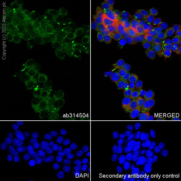 Immunocytochemistry/ Immunofluorescence - Anti-SQSTM1 / p62 antibody [RM1079] - Autophagosome Marker (AB314504)