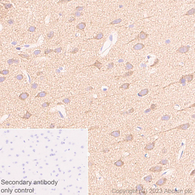 Immunohistochemistry (Formalin/PFA-fixed paraffin-embedded sections) - Anti-SQSTM1 / p62 antibody [RM1079] - Autophagosome Marker (AB314504)